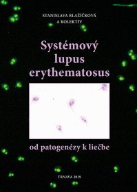 Systémový lupus erythematosus